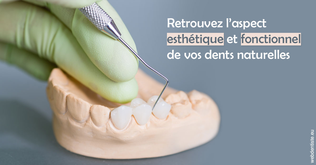 https://dr-renger-stephane.chirurgiens-dentistes.fr/Restaurations dentaires 1