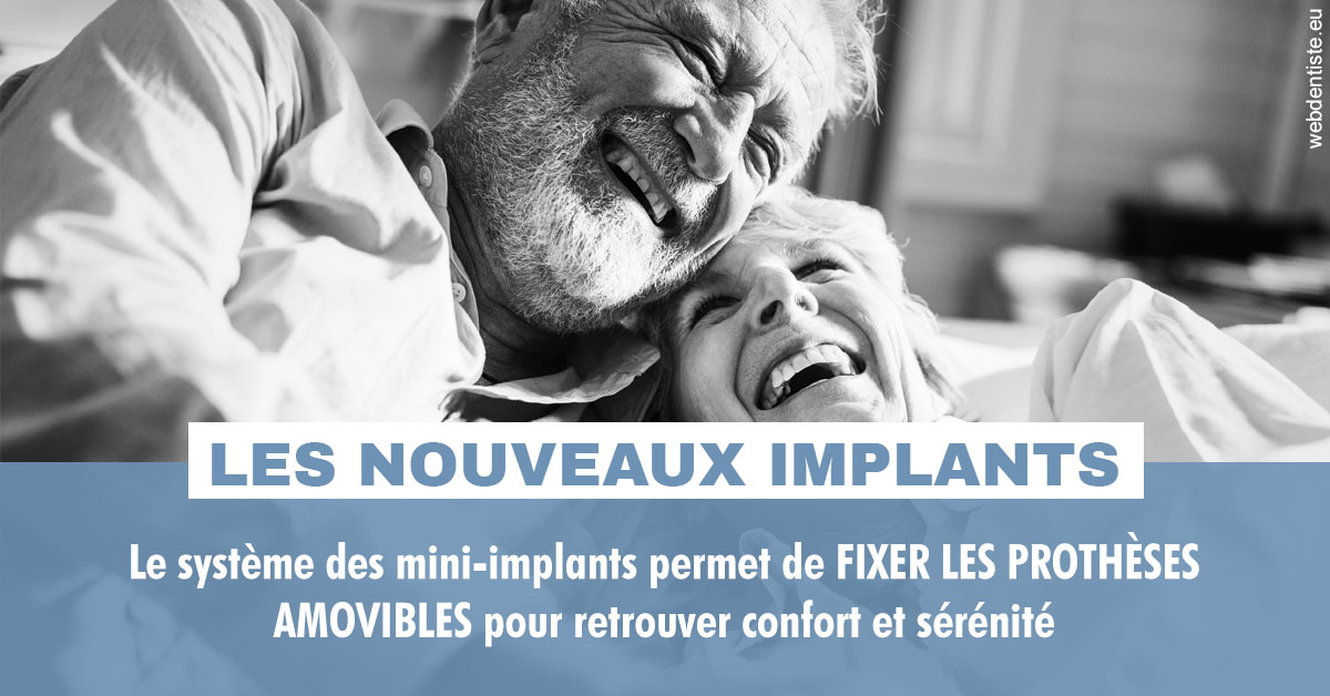 https://dr-renger-stephane.chirurgiens-dentistes.fr/Les nouveaux implants 2