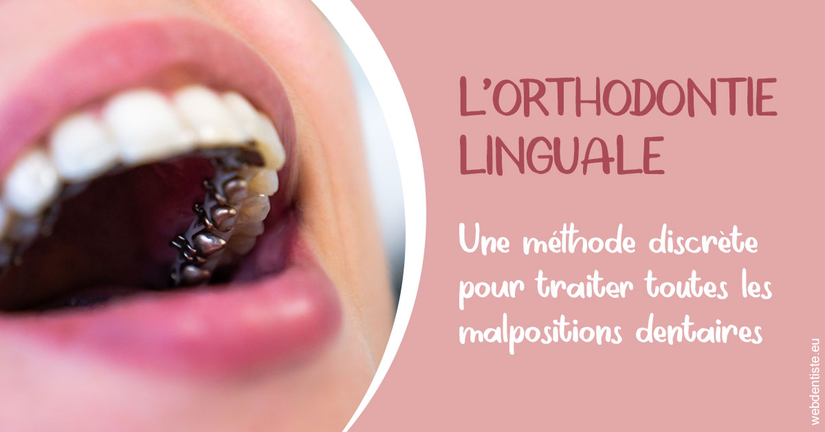 https://dr-renger-stephane.chirurgiens-dentistes.fr/L'orthodontie linguale 2