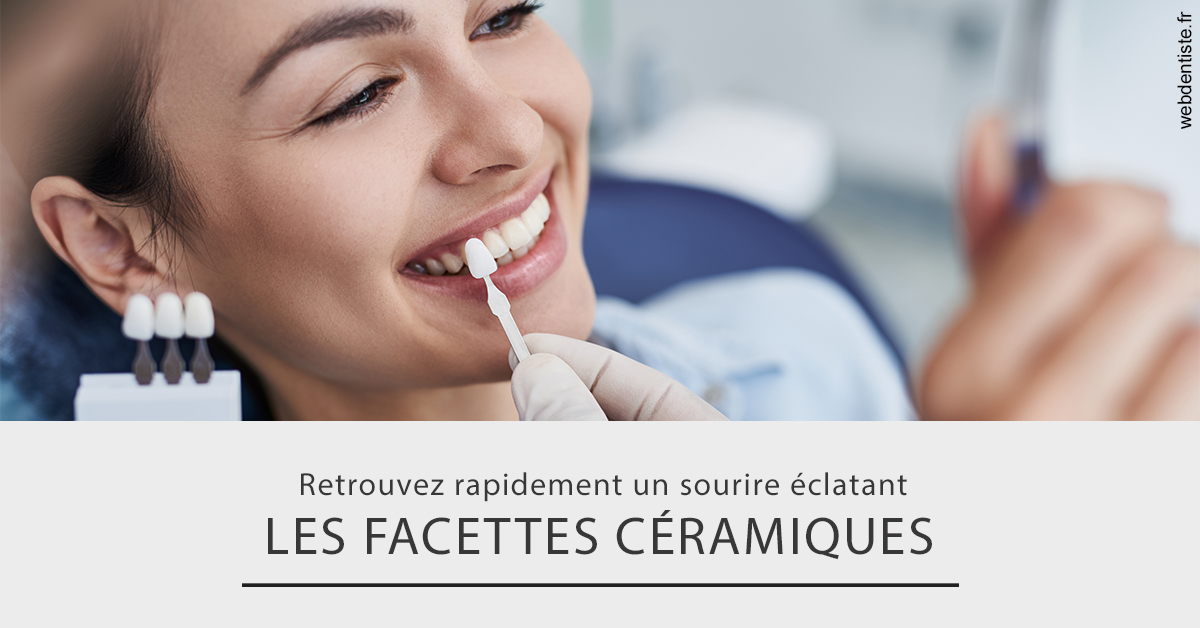 https://dr-renger-stephane.chirurgiens-dentistes.fr/Les facettes céramiques 2