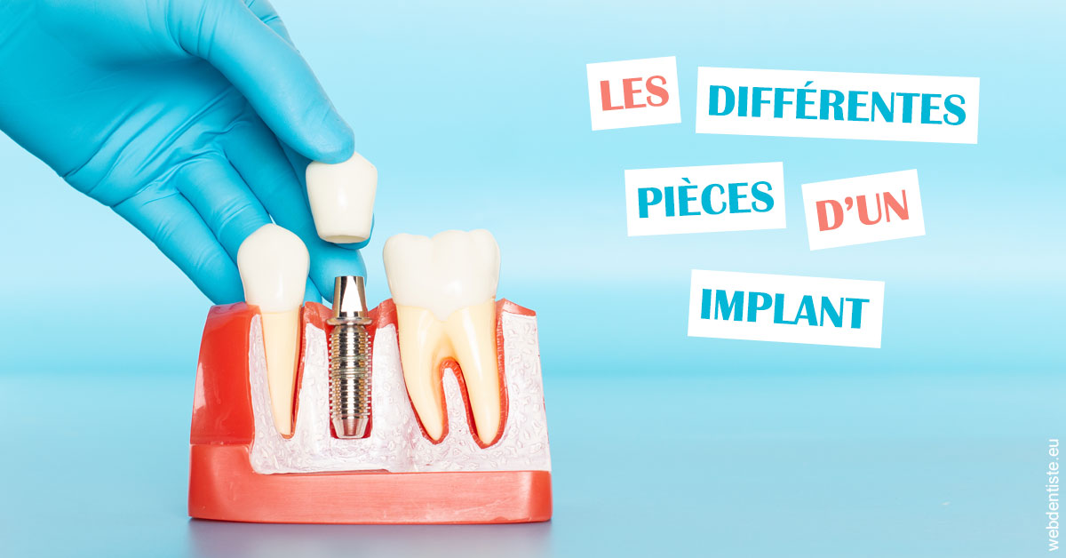 https://dr-renger-stephane.chirurgiens-dentistes.fr/Les différentes pièces d’un implant 2