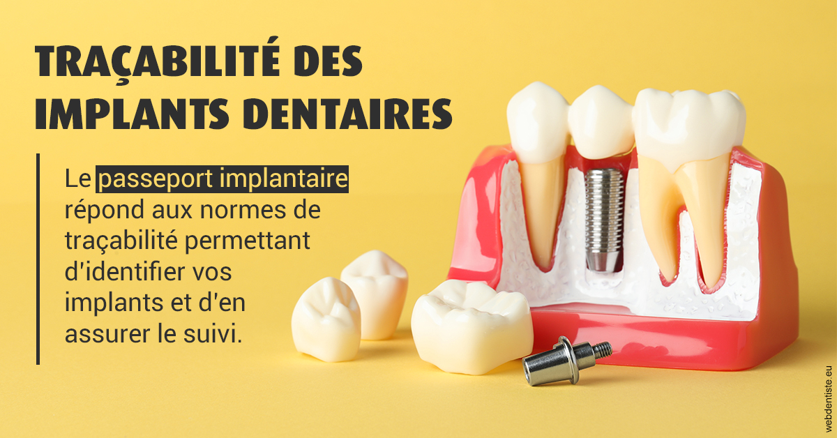 https://dr-renger-stephane.chirurgiens-dentistes.fr/T2 2023 - Traçabilité des implants 2
