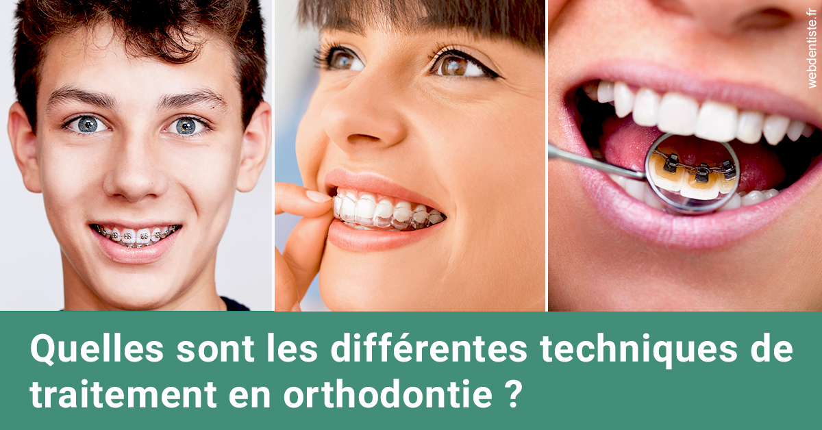 https://dr-renger-stephane.chirurgiens-dentistes.fr/Les différentes techniques de traitement 2