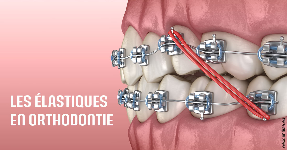 https://dr-renger-stephane.chirurgiens-dentistes.fr/Elastiques orthodontie 2