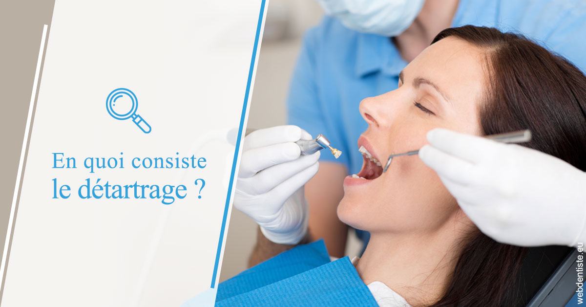 https://dr-renger-stephane.chirurgiens-dentistes.fr/En quoi consiste le détartrage