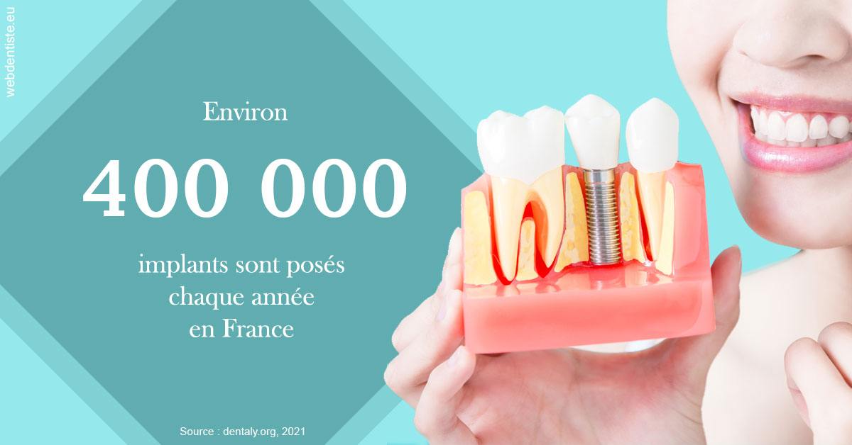 https://dr-renger-stephane.chirurgiens-dentistes.fr/Pose d'implants en France 2